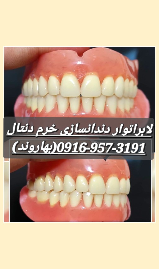 رفع لقی دندان مصنوعی