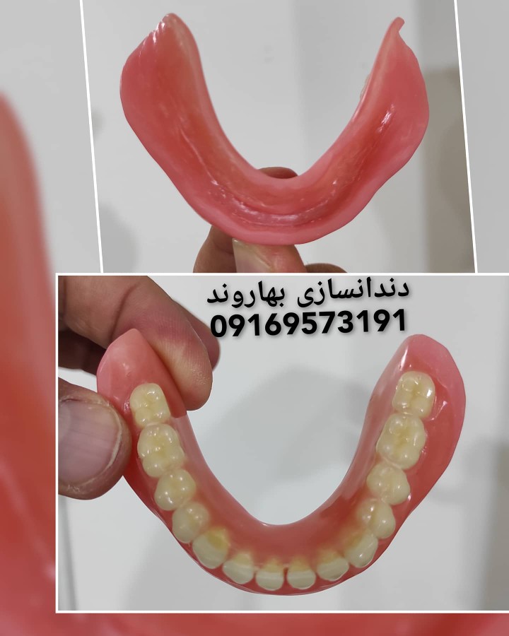 رفع لقی دندان مصنوعی